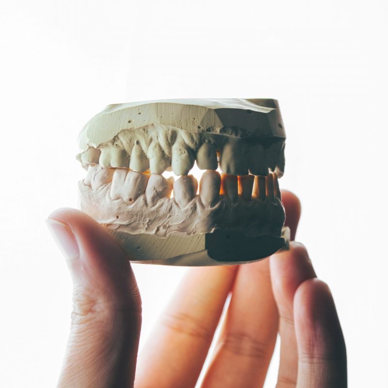 Pure Smiles Case Study